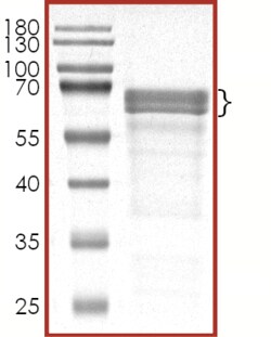 Sino Biological&nbsp;Recombinant Human Tau Protein (Tau-441), DYRK1A-phosphorylated